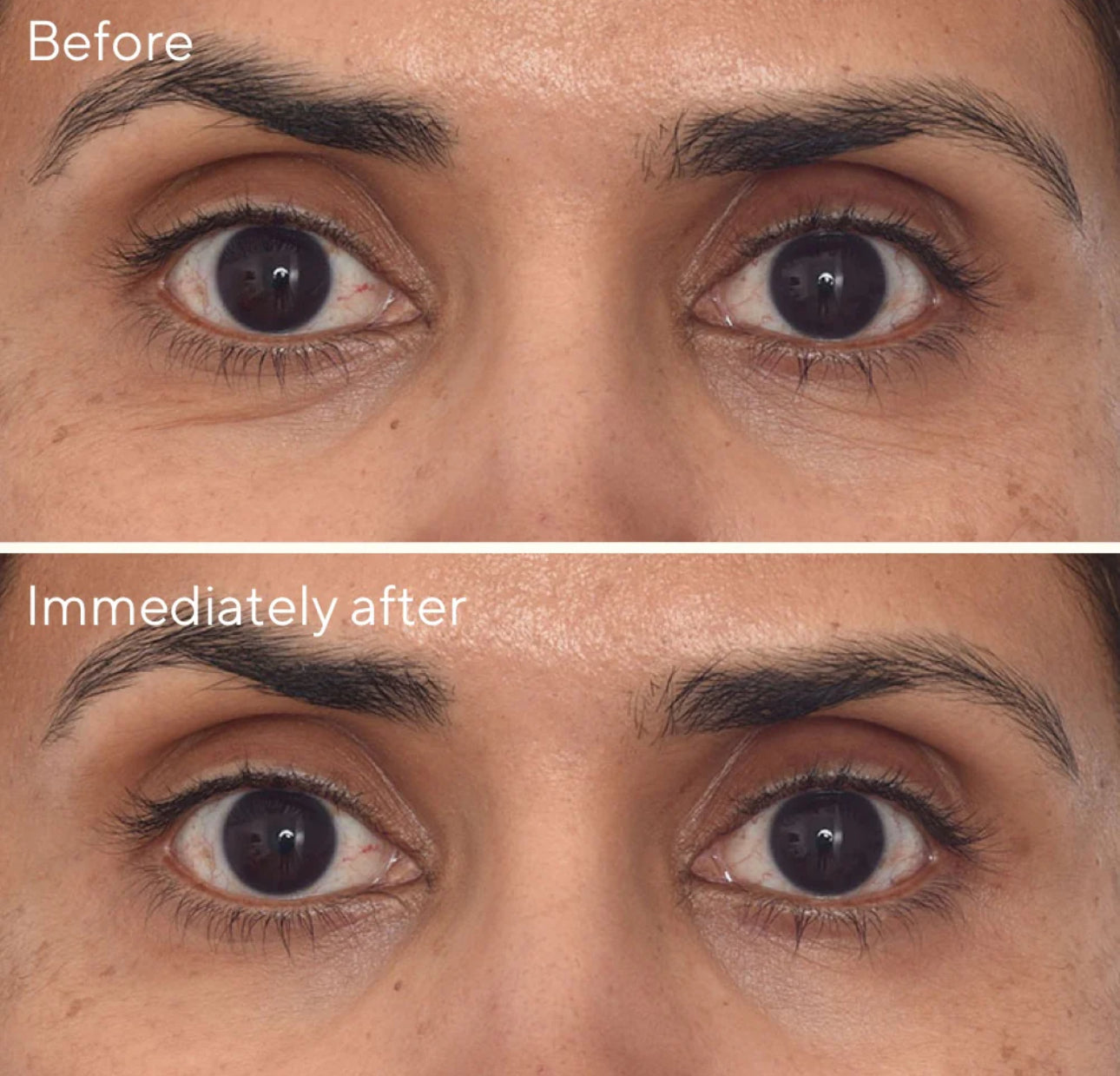 Retinol Youth Renewal Eye Mask - Single Pack
