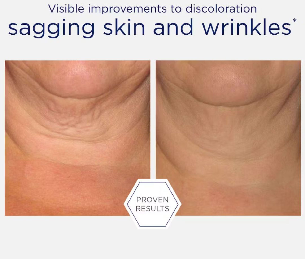 Neostrata Skin Active Triple Firming Neck Cream – 80 g / 2.8 oz.