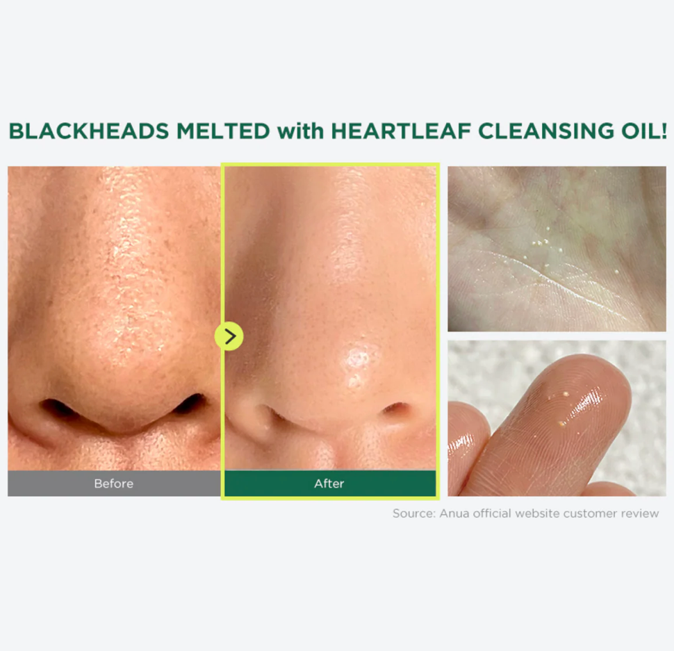 ANUA HEARTLEAF PORE CONTROL CLEANSING OIL 200ML
